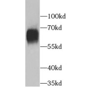 WB analysis of human blood tissue, using ALB antibody (1/300 dilution).