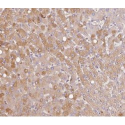 Albumin (ALB) Antibody