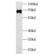 WB analysis of human plasma (1/5000 dilution), using Albumin antibody (1/10000 dilution).