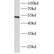 WB analysis of human liver tissue, using ALDH1A1 antibody (1/1000 dilution).