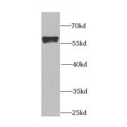 WB analysis of mouse testis tissue, using ALDH1A2 antibody (1/1000 dilution).
