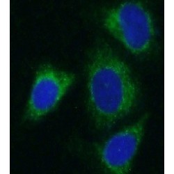 Aldehyde Dehydrogenase X, Mitochondrial (ALDH1B1) Antibody
