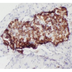 Aldehyde Dehydrogenase 1 Family Member L2 (ALDH1L2) Antibody
