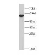 WB analysis of mouse lung tissue, using ALDH2 antibody (1/1000 dilution).