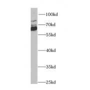 WB analysis of human heart tissue, using ALDH4A1 antibody (1/1000 dilution).