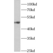 WB analysis of mouse pancreas tissue, using ALDH5A1 antibody (1/500 dilution).