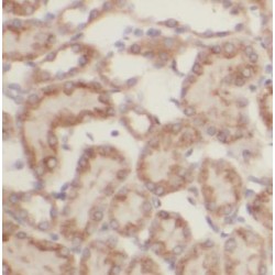Methylmalonate-Semialdehyde Dehydrogenase [acylating], Mitochondrial (ALDH6A1) Antibody