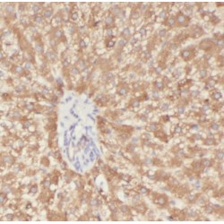 Fructose Bisphosphate Aldolase B (ALDOB) Antibody