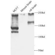 WB analysis of Various lysates, using ALK,CD246 antibody (1/600 dilution).