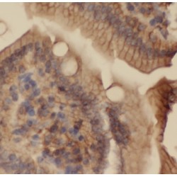 Nucleic Acid Dioxygenase ALKBH1 (ALKBH1) Antibody