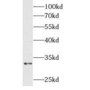 abx230313