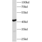 WB analysis of mouse heart tissue, using ACTC1 antibody (1/800 dilution).
