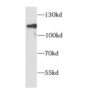 WB analysis of HEK-293 cells, using AP2A1 antibody (1/1000 dilution).