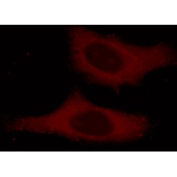 Alpha Tubulin (TUBA1B) Antibody