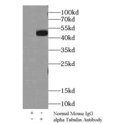 Alpha Tubulin (TUBA1B) Antibody