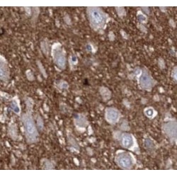 Alpha Synuclein (SNCA) Antibody