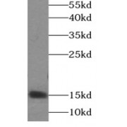 WB analysis of mouse brain tissue, using SNCA antibody (1/1000 dilution).
