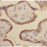 abx230348