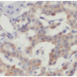 Alsin (ALS2) Antibody