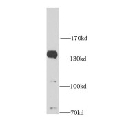 WB analysis of mouse brain tissue, using AMBRA1 antibody (1/1000 dilution).