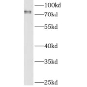 abx230358