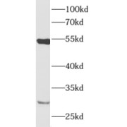 abx230361