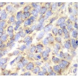 Aminoacylase 1 (ACY1) Antibody
