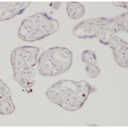 Angiomotin (AMOT) Antibody