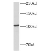 WB analysis of human liver tissue, using AMPD2 antibody (1/500 dilution).