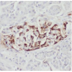 Amphiphysin (AMPH) Antibody