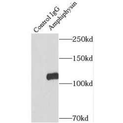 Amphiphysin (AMPH) Antibody