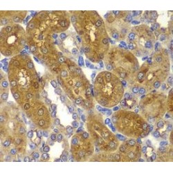 5'-AMP-Activated Protein Kinase Subunit Beta-1 (AMPK beta 1) Antibody