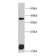 WB analysis of mouse liver tissue, using PRKAB1 antibody (1/1000 dilution).