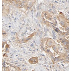 Amylase, alpha Antibody