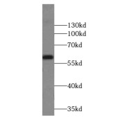 WB analysis of mouse skeletal muscle tissue, using AMY2B antibody (1/400 dilution).