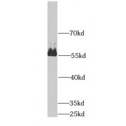 WB analysis of human liver tissue, using AMY2A antibody (1/500 dilution).