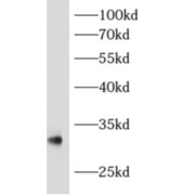 abx230385