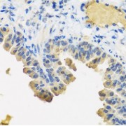 IHC analysis of paraffin-embedded human esophagus, using ANGPT1 Antibody (1/100 dilution).