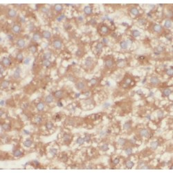 Angiotensinogen (AGT) Antibody