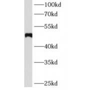 WB analysis of HepG2 cells, using AGT antibody (1/600 dilution).