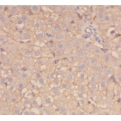 Angiotensinogen (AGT) Antibody