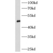 WB analysis of human plasma tissue, using AGT antibody (1/1000 dilution).