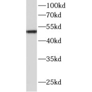 WB analysis of HepG2 cells, using AGT antibody (1/1000 dilution).