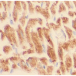 Angiopoietin-Related Protein 2 (ANGPTL2) Antibody