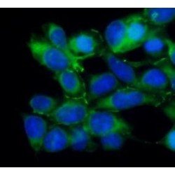 Angiopoietin-Related Protein 4 (ANGPTL4) Antibody