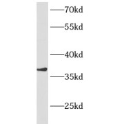 abx230404