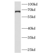 WB analysis of HeLa cells, usingANKRD13A (ANKRD13A antibody (1/300 dilution).