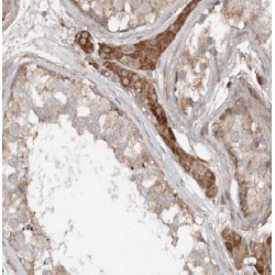 Ankyrin Repeat Domain 13B (ANKRD13B) Antibody