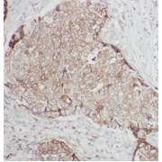 abx230411