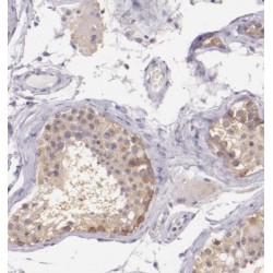 Ankyrin Repeat Domain 53 (ANKRD53) Antibody